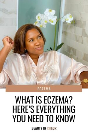 WHAT IS ECZEMA? HERE’S EVERYTHING YOU NEED TO KNOW